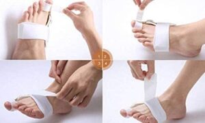 Hinged Splint for Toe Alignment and Bunions, 1 Pair-B07MWD338M