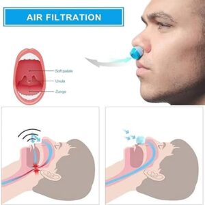 1 Pcs (White) 2 in 1 Health Anti Snoring & Air Purifier Relieve Nasal Congestion Snoring Device Ventilation Anti-snoring Anti Snore Nose Clip-B0C2GLCWJC