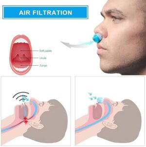 1 Pcs (RED) 2 in 1 Health Anti Snoring & Air Purifier Relieve Nasal Congestion Snoring Device Ventilation Anti-snoring Anti Snore Nose Clip-B0BWQ3X5JJ