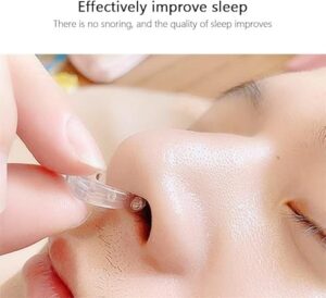 Prevent SnoringNose Congestion Help SleepSnoring DeviceNose Breathing Relieve SnoringAid Nasal Congestion Clip Cure Snoring Tool-B0C4LN5VQM