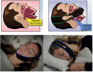 [1 PC] Tcare 1Piece Snoring Chin Strap Adjustable Anti Snore Chin Strap Support Stop Snoring- Natural and Instant Snore Relief Jaw Belt [Random Color]-‎ B0CHPNQB4B