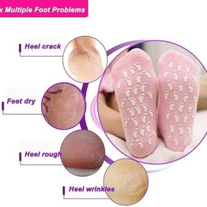 61FzfgU1nRL._AC_SX522_ Silicon Socks Heel for Crack (1 Pair) Spa Gel Socks for Women and Men, Feet Protector Crack Heel Repair Socks with Moisturizing Natural Oil and Vitamin E Repair Dry Cracked Feet, (Blue)-B0DFCDTXYB