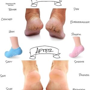 Silicon Socks Heel for Crack (1 Pair) Spa Gel Socks for Women and Men, Feet Protector Crack Heel Repair Socks with Moisturizing Natural Oil and Vitamin E Repair Dry Cracked Feet (Black)-B0DT4R3ZS8