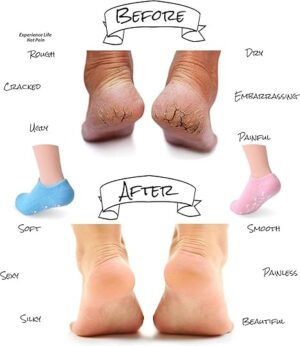 Silicon Socks Heel for Crack (1 Pair) Spa Gel Socks for Women and Men, Feet Protector Crack Heel Repair Socks with Moisturizing Natural Oil and Vitamin E Repair Dry Cracked Feet (Black)-B0DT4R3ZS8