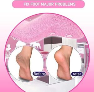 Silicon Socks Heel for Crack (1 Pair) Spa Gel Socks for Women and Men, Feet Protector Crack Heel Repair Socks with Moisturizing Natural Oil and Vitamin E Repair Dry Cracked Feet (Black)-B0DT4R3ZS8