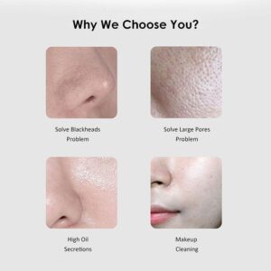 -Ultrasonic Facial Skin Scrubber – 3 Modes + 2 Silicone Brushes + USB Charger-B0FKH59ZGY