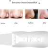 -Ultrasonic Facial Skin Scrubber – 3 Modes + 2 Silicone Brushes + USB Charger-B0FKH59ZGY