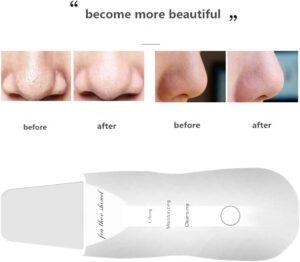 -Ultrasonic Facial Skin Scrubber – 3 Modes + 2 Silicone Brushes + USB Charger-B0FKH59ZGY