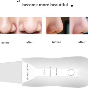 51Eg2P5yERL._AC_ -Ultrasonic Facial Skin Scrubber – 3 Modes + 2 Silicone Brushes + USB Charger-B0FKH59ZGY