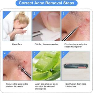 مجموعة إبر حب الشباب (4 قطع)، علاج الرؤوس السوداء والبثور-B0G1MYRPHX